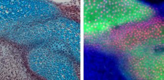 Hints at jaw evolution found in marsupials and monotremes (Study) Hints at jaw evolution found in marsupials and monotremes
