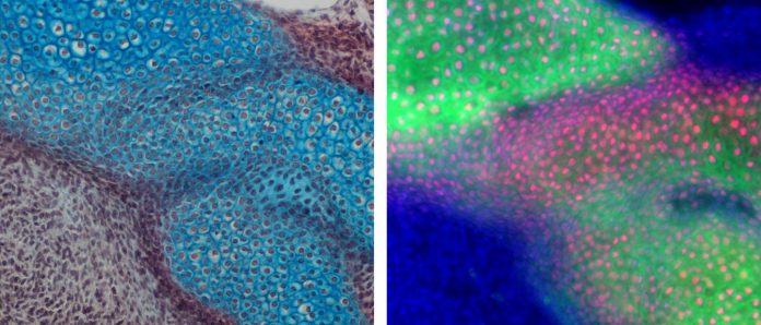 Hints at jaw evolution found in marsupials and monotremes