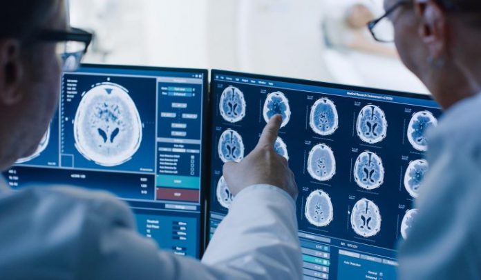 Report: Rife with obstacles and occlusions, terrestrial environments potentially helped give rise to planning circuits in the brain