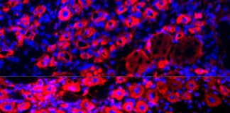 Study: Diluting blood plasma helps achieve age-reversing effects in mice Study: Diluting blood plasma helps achieve age-reversing effects in mice