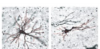 How does our brain fold? Study reveals new genetic insights How does our brain fold? Study reveals new genetic insights
