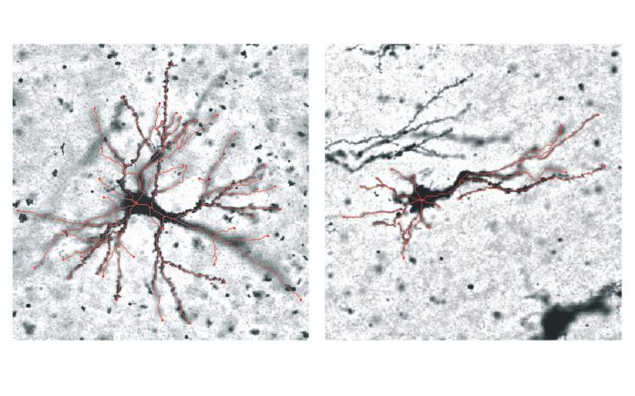 How does our brain fold? Study reveals new genetic insights