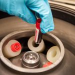 Report: An early morning whey protein snack increases morning blood sugar level in healthy people An early morning whey protein snack increases morning blood sugar level in healthy people