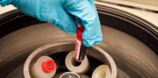 Report: An early morning whey protein snack increases morning blood sugar level in healthy people An early morning whey protein snack increases morning blood sugar level in healthy people