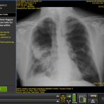 Report: GE Healthcare chooses UH to clinically evaluate first-of-its-kind imaging system GE Healthcare chooses UH to clinically evaluate first-of-its-kind imaging system