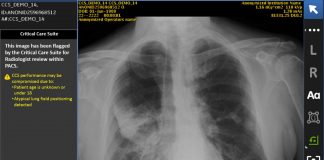 Report: GE Healthcare chooses UH to clinically evaluate first-of-its-kind imaging system GE Healthcare chooses UH to clinically evaluate first-of-its-kind imaging system