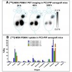 Report: New theranostic agents show efficacy in prostate cancer treatment in preclinical studies New theranostic agents show efficacy in prostate cancer treatment in preclinical studies
