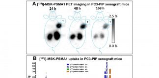 Report: New theranostic agents show efficacy in prostate cancer treatment in preclinical studies New theranostic agents show efficacy in prostate cancer treatment in preclinical studies