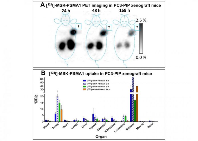 New theranostic agents show efficacy in prostate cancer treatment in preclinical studies