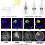 Report: New PET radiotracer proven safe and effective in imaging malignant brain tumors New PET radiotracer proven safe and effective in imaging malignant brain tumors
