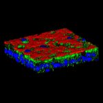Report: Cystic fibrosis: why so many respiratory complications? Cystic fibrosis: why so many respiratory complications?