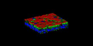 Report: Cystic fibrosis: why so many respiratory complications? Cystic fibrosis: why so many respiratory complications?