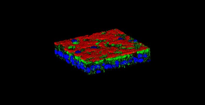 Cystic fibrosis: why so many respiratory complications?