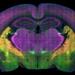 Report: Autism researchers map brain circuitry of social preference Autism researchers map brain circuitry of social preference