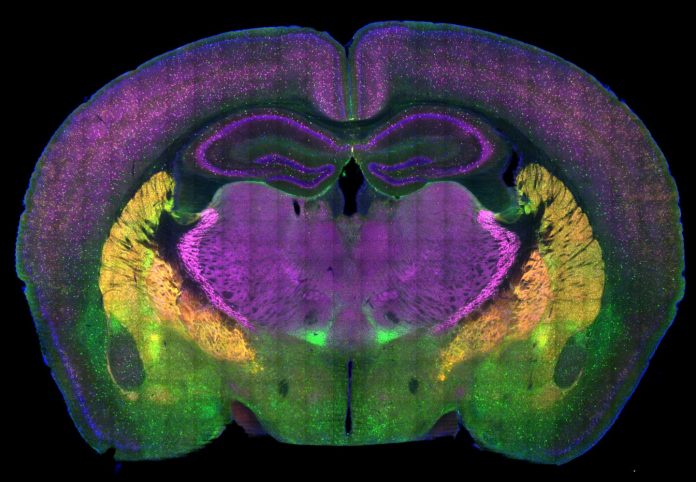 Autism researchers map brain circuitry of social preference