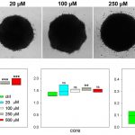 Report: Oncotarget: Tumor markers for carcinoma identified by imaging mass spectrometry Oncotarget: Tumor markers for carcinoma identified by imaging mass spectrometry