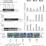 Report: Oncotarget: The Golgi protein TMEM165 controls migration/invasion for carcinoma Oncotarget: The Golgi protein TMEM165 controls migration/invasion for carcinoma