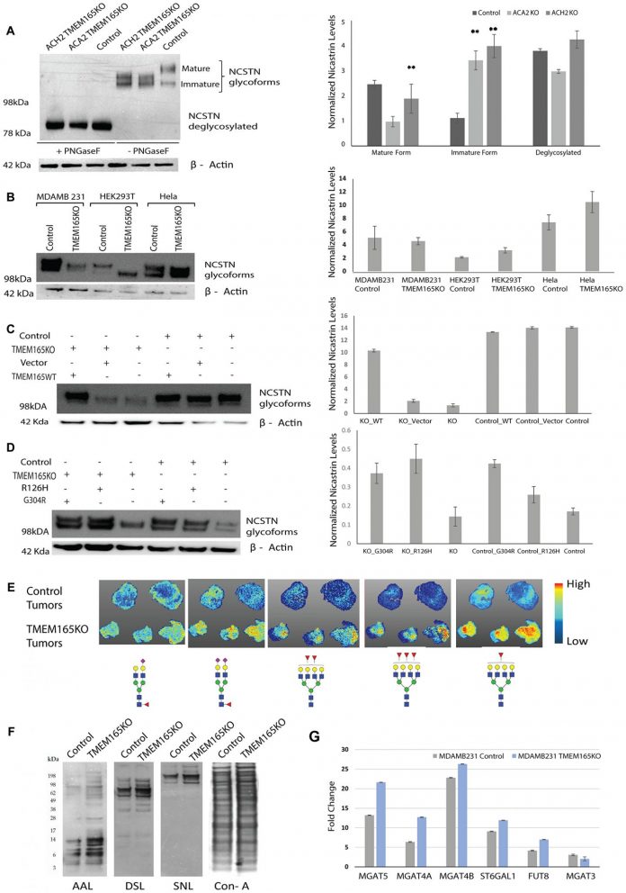 Oncotarget: The Golgi protein TMEM165 controls migration/invasion for carcinoma