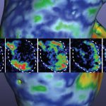 Report: Research brief: Researchers 3D print a working heart pump with real human cells Research brief: Researchers 3D print a working heart pump with real human cells