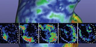 Report: Research brief: Researchers 3D print a working heart pump with real human cells Research brief: Researchers 3D print a working heart pump with real human cells