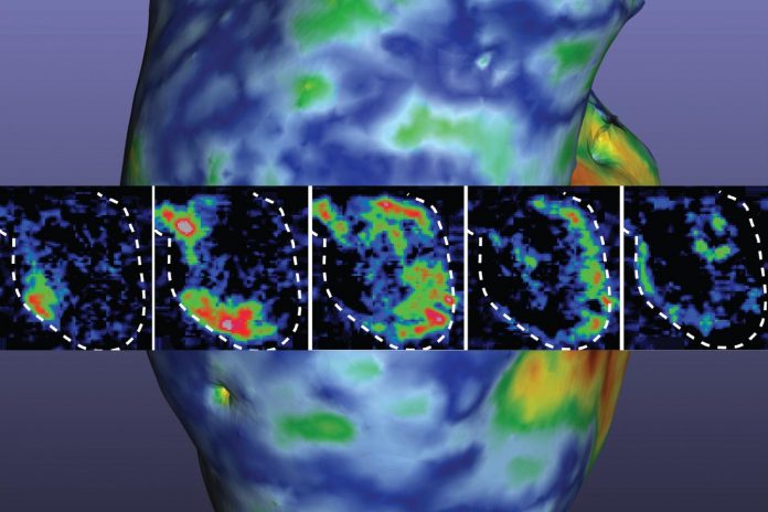 Research brief: Researchers 3D print a working heart pump with real human cells