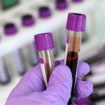 Alzheimer’s blood tests show new promise, says new research Alzheimer's blood tests show new promise, says new research