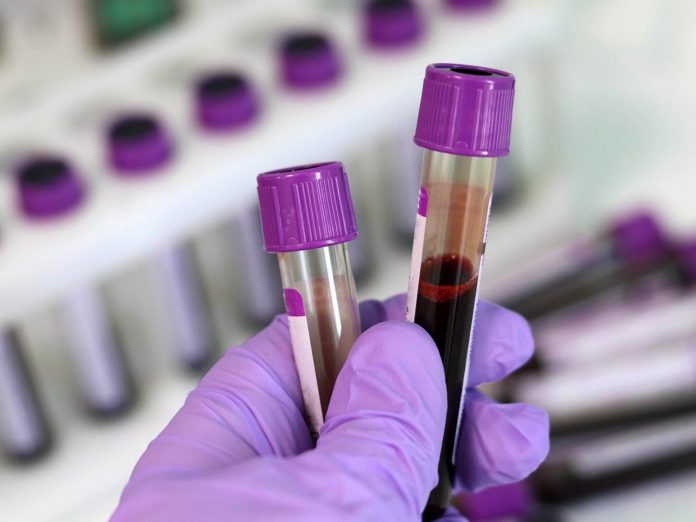 Alzheimer's blood tests show new promise, says new research
