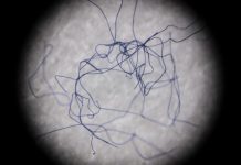 Atmospheric: Devices can reduce fibers produced in laundry cycle by up to 80% Devices can reduce fibers produced in laundry cycle by up to 80%