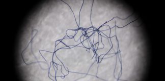 Atmospheric: Devices can reduce fibers produced in laundry cycle by up to 80% Devices can reduce fibers produced in laundry cycle by up to 80%