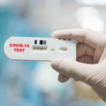 Coronavirus: Rapid test for the determination of antibodies against SARS-CoV-2 Coronavirus: Rapid test for the determination of antibodies against SARS-CoV-2