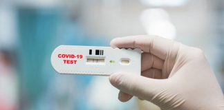 Coronavirus: Rapid test for the determination of antibodies against SARS-CoV-2 Coronavirus: Rapid test for the determination of antibodies against SARS-CoV-2