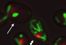 Researchers are one step closer to delaying aging (Video) Researchers are one step closer to delaying aging (Video)