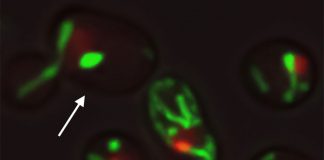 Researchers are one step closer to delaying aging (Video) Researchers are one step closer to delaying aging (Video)