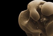 Researchers discovers METAL-EATING bacteria after leaving glass jar out in sink Researchers discovers METAL-EATING bacteria after leaving glass jar out in sink