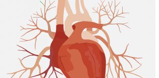 Study: Cholesterol-Lowering Drug Improved Function of Heart’s Arteries Study: Cholesterol-Lowering Drug Improved Function of Heart’s Arteries