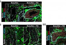 Tech: Healthy offspring from testicular tissue plantation in mice: Retinoic acid key Healthy offspring from testicular tissue plantation in mice: Retinoic acid key