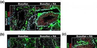 Tech: Healthy offspring from testicular tissue plantation in mice: Retinoic acid key Healthy offspring from testicular tissue plantation in mice: Retinoic acid key
