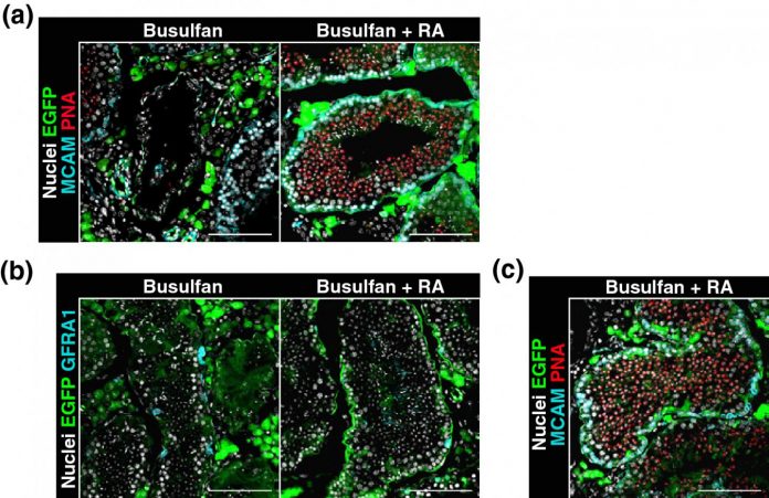 Healthy offspring from testicular tissue plantation in mice: Retinoic acid key