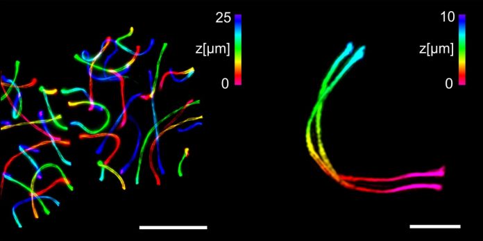 High-end microscopy refined | EurekAlert! Science News