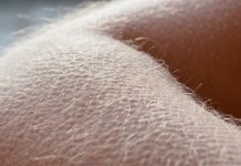 The hair-raising reason for goosebumps, Says New Study The hair-raising reason for goosebumps, Says New Study