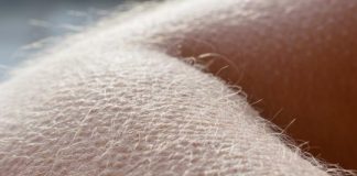 The hair-raising reason for goosebumps, Says New Study The hair-raising reason for goosebumps, Says New Study