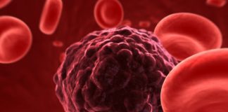 Study: A simpler, high-accuracy method to detect rare circulating tumor cells in blood samples Study: A simpler, high-accuracy method to detect rare circulating tumor cells in blood samples