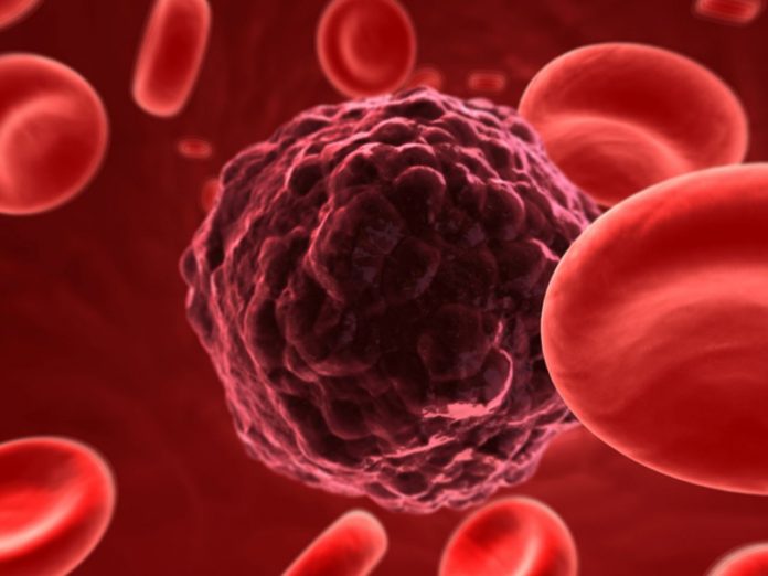Study: A simpler, high-accuracy method to detect rare circulating tumor cells in blood samples