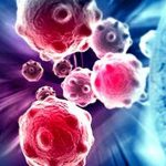 Study: Blood cancer patients are most vulnerable to COVID-19 Study: Blood cancer patients are most vulnerable to COVID-19