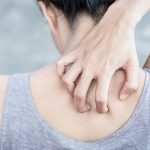 Research Ties Chronic Itch to Sleep Loss and Possible Signal of Increased Heart Disease Risk Research Ties Chronic Itch to Sleep Loss and Possible Signal of Increased Heart Disease Risk