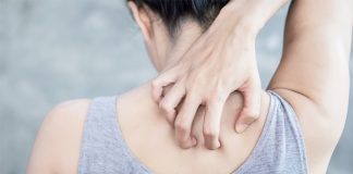 Research Ties Chronic Itch to Sleep Loss and Possible Signal of Increased Heart Disease Risk Research Ties Chronic Itch to Sleep Loss and Possible Signal of Increased Heart Disease Risk