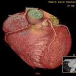 Research may explain why hormone therapy slows progression of heart disease Research may explain why hormone therapy slows progression of heart disease