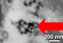 Study: Air pollution particles and metals found in the placenta Study: Air pollution particles and metals found in the placenta