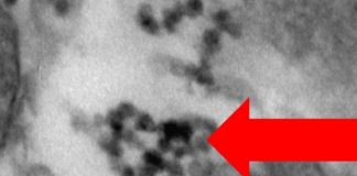 Study: Air pollution particles and metals found in the placenta Study: Air pollution particles and metals found in the placenta
