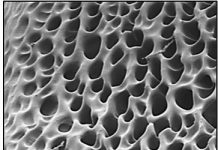 Biology: A hydrogel that could help repair damaged nerves